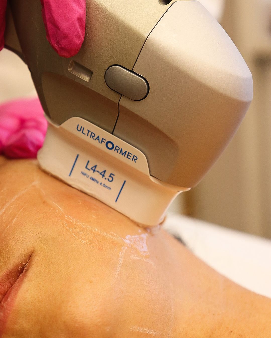 Tratamento Ultraformer